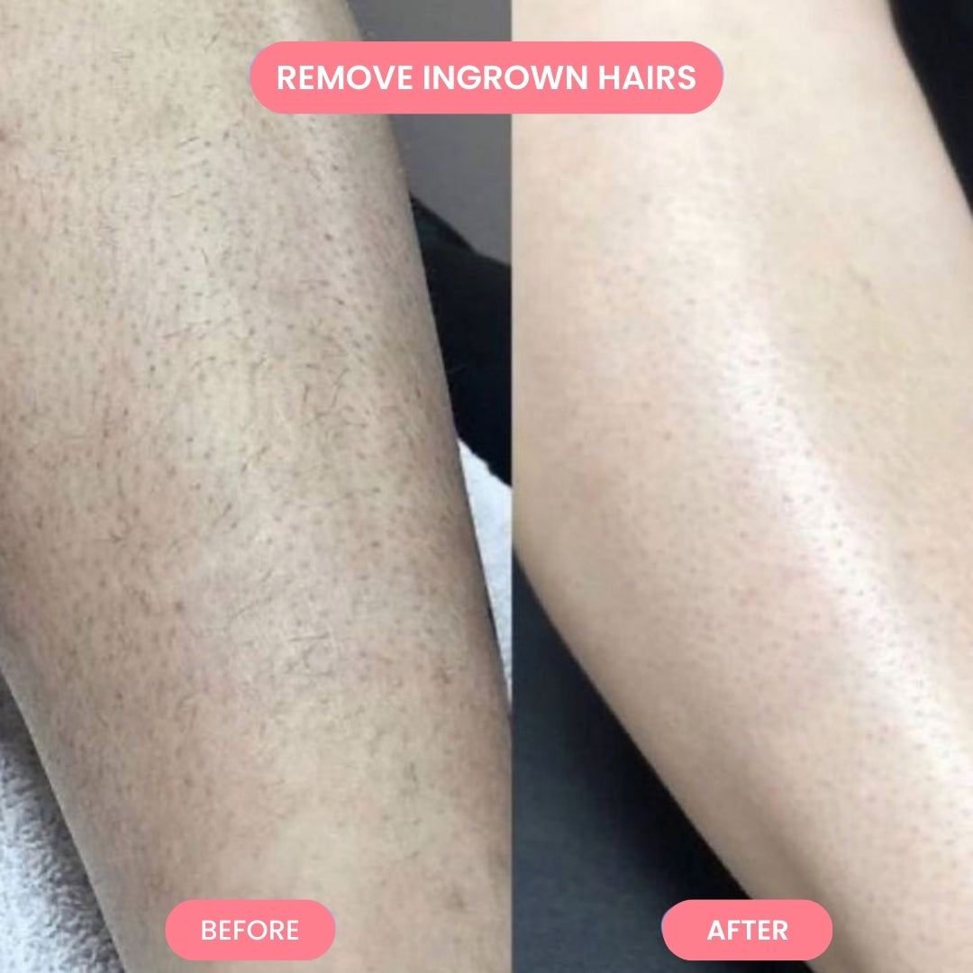 Smoothly Hair Remover